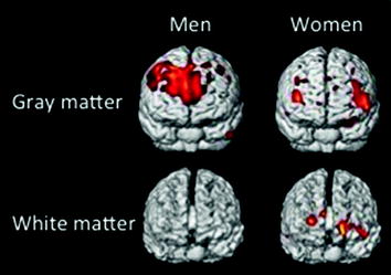 Like a Circus The Public Consumption of Sex Differences 